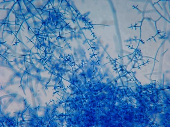 Microscopic View of Trichoderma